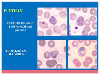 P. VIVAX
ESTÁGIO DE ANEL
(TROFOZOÍTAS
jovens)

TROFOZOÍTAS
MADUROS

 