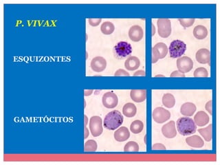 P. VIVAX

ESQUIZONTES

GAMETÓCITOS

 