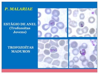 P. MALARIAE

ESTÁGIO DE ANEL
(Trofozoítas
Jovens)

TROFOZOÍTAS
MADUROS

 