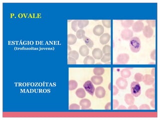 P. OVALE

ESTÁGIO DE ANEL
(trofozoítas jovens)

TROFOZOÍTAS
MADUROS

 