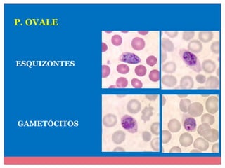 P. OVALE

ESQUIZONTES

GAMETÓCITOS

 