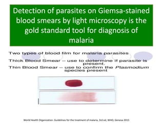 Detection of parasites on Giemsa-stained
blood smears by light microscopy is the
gold standard tool for diagnosis of
malaria
World Health Organization. Guidelines for the treatment of malaria, 3rd ed, WHO, Geneva 2015
 