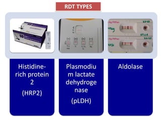 Histidine-
rich protein
2
(HRP2)
Plasmodiu
m lactate
dehydroge
nase
(pLDH)
Aldolase
RDT TYPES
 