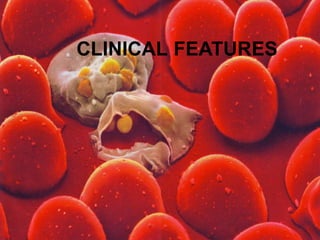 CLINICAL FEATURES
 