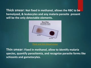 Thick smear: Not fixed in methanol, allows the RBC to be
hemolyzed, & leukocytes and any malaria parasite present
will be the only detectable elements.
Thick and thin blood smear
Thin smear: Fixed in methanol, allow to identify malaria
species, quantify parasitemia, and recognize parasite forms like
schizonts and gametocytes.
 