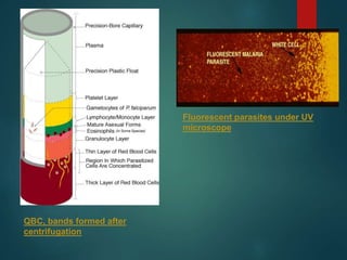 QBC, bands formed after
centrifugation
Fluorescent parasites under UV
microscope
 