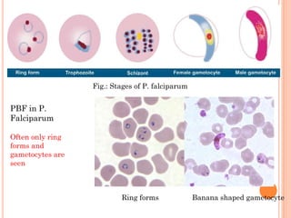 Pbf Form Malarial parasite major focus on hemoparasites which are common.ppt.pdf