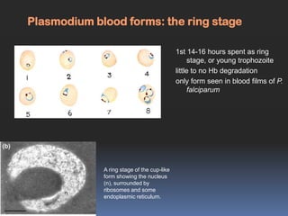 Plasmodium blood forms: the ring stage

                                            1st 14-16 hours spent as ring
                                                  stage, or young trophozoite
                                            little to no Hb degradation
                                            only form seen in blood films of P.
                                                  falciparum




             A ring stage of the cup-like
             form showing the nucleus
             (n), surrounded by
             ribosomes and some
             endoplasmic reticulum.
 
