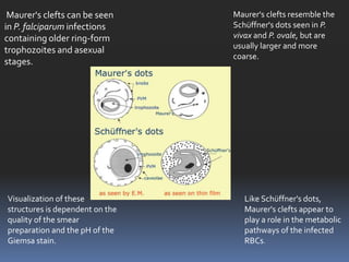 Maurer's clefts can be seen     Maurer's clefts resemble the
in P. falciparum infections      Schüffner's dots seen in P.
containing older ring-form       vivax and P. ovale, but are
trophozoites and asexual         usually larger and more
                                 coarse.
stages.




Visualization of these              Like Schüffner's dots,
structures is dependent on the      Maurer's clefts appear to
quality of the smear                play a role in the metabolic
preparation and the pH of the       pathways of the infected
Giemsa stain.                       RBCs.
 