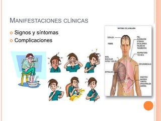 MANIFESTACIONES CLÍNICAS
 Signos y síntomas
 Complicaciones
 