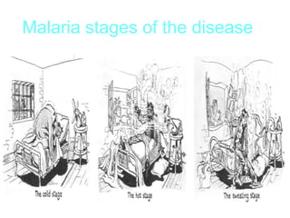 Malaria stages of the disease
 