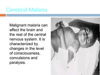Cerebral Malaria
Malignant malaria can
affect the brain and
the rest of the central
nervous system. It is
characterized by
changes in the level
of consciousness,
convulsions and
paralysis.
 