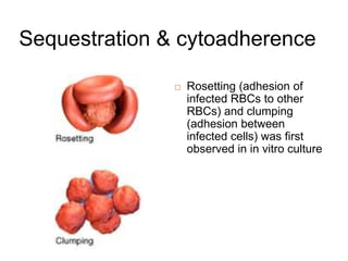 Sequestration & cytoadherence
 Rosetting (adhesion of
infected RBCs to other
RBCs) and clumping
(adhesion between
infected cells) was first
observed in in vitro culture
 