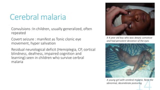 Cerebral malaria
Convulsions :In children, usually generalized, often
repeated
Covert seizure : manifest as Tonic clonic eye
movement, hyper salivation
Residual neurological deficit (Hemiplegia, CP, cortical
blindness, deafness, impaired cognition and
learning) seen in children who survive cerbral
malaria
A 4 year old boy who was deeply comatose
and had persistent deviation of the eyes
A young girl with cerebral malaria. Note the
abnormal, decerebrate posturing
 
