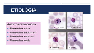 ETIOLOGIA
AGENTES ETIOLOGICOS:
 Plasmodium vivax
 Plasmodium falciparum
 Plasmodium malariae
 Plasmodium ovale
 