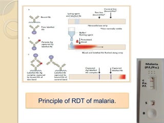 MALARIA UPDATES- details on malaria, investigation, interpretation ...