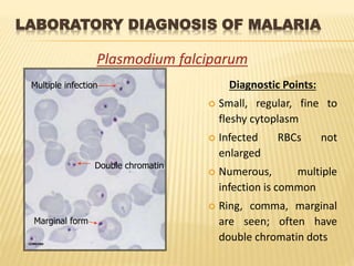 LABORATORY DIAGNOSIS OF MALARIA
Plasmodium falciparum
Diagnostic Points:
 Small, regular, fine to
fleshy cytoplasm
 Infected RBCs not
enlarged
 Numerous, multiple
infection is common
 Ring, comma, marginal
are seen; often have
double chromatin dotsCCMOVBD
Multiple infection
Marginal form
Double chromatin
 