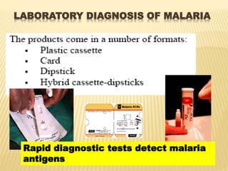 LABORATORY DIAGNOSIS OF MALARIA
Rapid diagnostic tests detect malaria
antigens
 