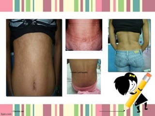 • Atlas Lachapelle. 
• Dermis.net 
 