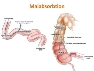 Malabsorbtion
 