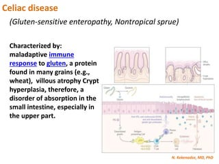 N. Kekenadze, MD, PhD
Celiac disease
(Gluten-sensitive enteropathy, Nontropical sprue)
Characterized by:
maladaptive immune
response to gluten, a protein
found in many grains (e.g.,
wheat), villous atrophy Crypt
hyperplasia, therefore, a
disorder of absorption in the
small intestine, especially in
the upper part.
 