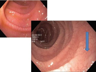 N. Kekenadze, MD, PhD
 