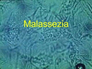 Malassezia 