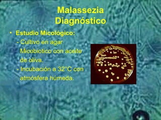 Malassezia PPT Malassezia PPT