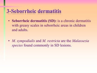 • Seborrheic dermatitis (SD): is a chronic dermatitis
with greasy scales in seborrheic areas in children
and adults.
• M. sympodialis and M. restricta are the Malassezia
species found commonly in SD lesions.
 