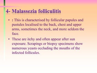• : This is characterised by follicular papules and
pustules localised to the back, chest and upper
arms, sometimes the neck, and more seldom the
face.
• These are itchy and often appear after sun
exposure. Scrapings or biopsy specimens show
numerous yeasts occluding the mouths of the
infected follicules.
 