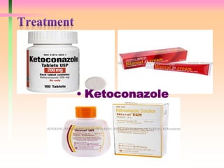 • Ketoconazole
 