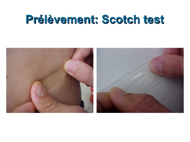 Scoth Test Scotch Test Labo – Comment Faire Un Scotch Test – ATEEP