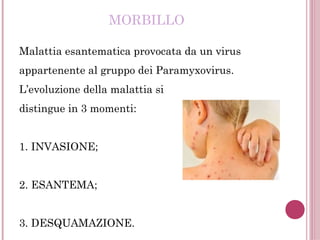 MORBILLO
Malattia esantematica provocata da un virus
appartenente al gruppo dei Paramyxovirus.
L’evoluzione della malattia si
distingue in 3 momenti:
1. INVASIONE;
2. ESANTEMA;
3. DESQUAMAZIONE.
 