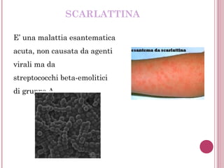 SCARLATTINA
E’ una malattia esantematica
acuta, non causata da agenti
virali ma da
streptococchi beta-emolitici
di gruppo A.
 