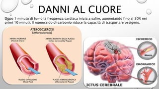 DANNI AL CUORE
Dopo 1 minuto di fumo la frequenza cardiaca inizia a salire, aumentando fino al 30% nei
primi 10 minuti. Il monossido di carbonio riduce la capacità di trasportare ossigeno.
 