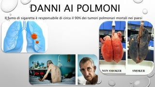 DANNI AI POLMONI
Il fumo di sigaretta è responsabile di circa il 90% dei tumori polmonari mortali nei paesi
sviluppati.
 