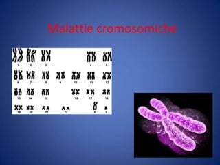 Malattie cromosomiche
 