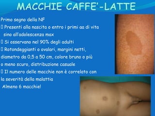 Le macchie caffe’-latte e le lentiggini non sono sempre
sintomo di NF, ma possono essere:
􀀹 Idiopatiche
􀀹 S. di Leopard
􀀹 ...