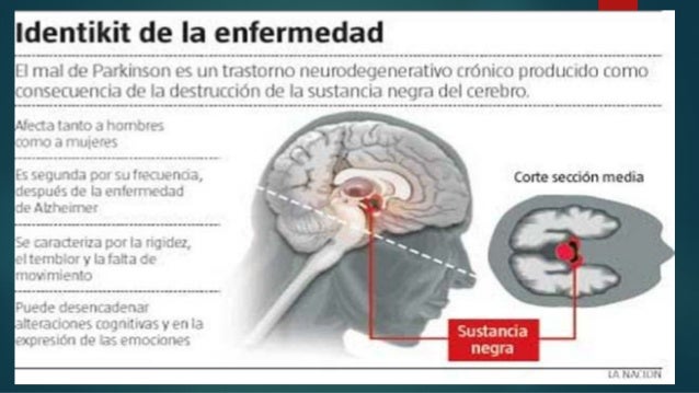 Como limpiar a la persona de las ojeras