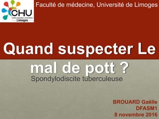 Quand suspecter Le
mal de pott ?
Spondylodiscite tuberculeuse
Faculté de médecine, Université de Limoges
BROUARD Gaëlle
DFASM1
8 novembre 2016
 