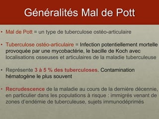 MAL DE POTT pptx mal-de-pott-pptx