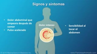• Dolor abdominal que
empeora después de
comer
• Pulso acelerado
• Sensibilidad al
tocar el
abdomen
 
