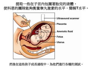 提取一些在子宮內包圍著胎兒的液體，
使科恩的團隊能夠衡量睾丸激素的水平，簡稱T水平。
然後在這些孩子成長過程中，為他們進行各種的測試。
 