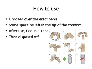 How to use
• Unrolled over the erect penis
• Some space be left in the tip of the condom
• After use, tied in a knot
• Then disposed off
 