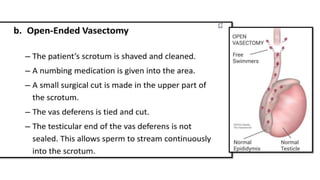 male contraception- powerpoint presentation