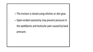male contraception- powerpoint presentation