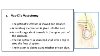 male contraception- powerpoint presentation