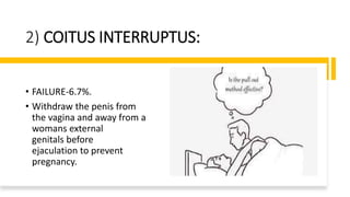 2) COITUS INTERRUPTUS:
• FAILURE-6.7%.
• Withdraw the penis from
the vagina and away from a
womans external
genitals before
ejaculation to prevent
pregnancy.
 