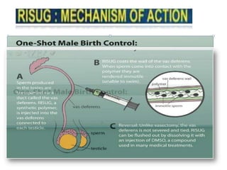 Male contraceptive risug