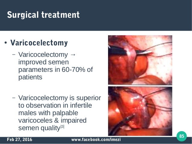 Male factor infertility Male factor infertility